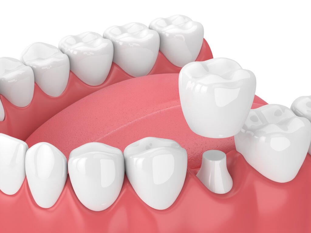 - Balsam Dental