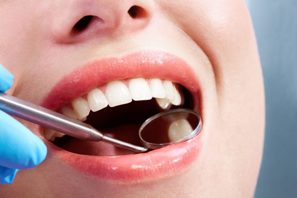 - Balsam Dental