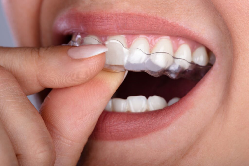 - Balsam Dental
