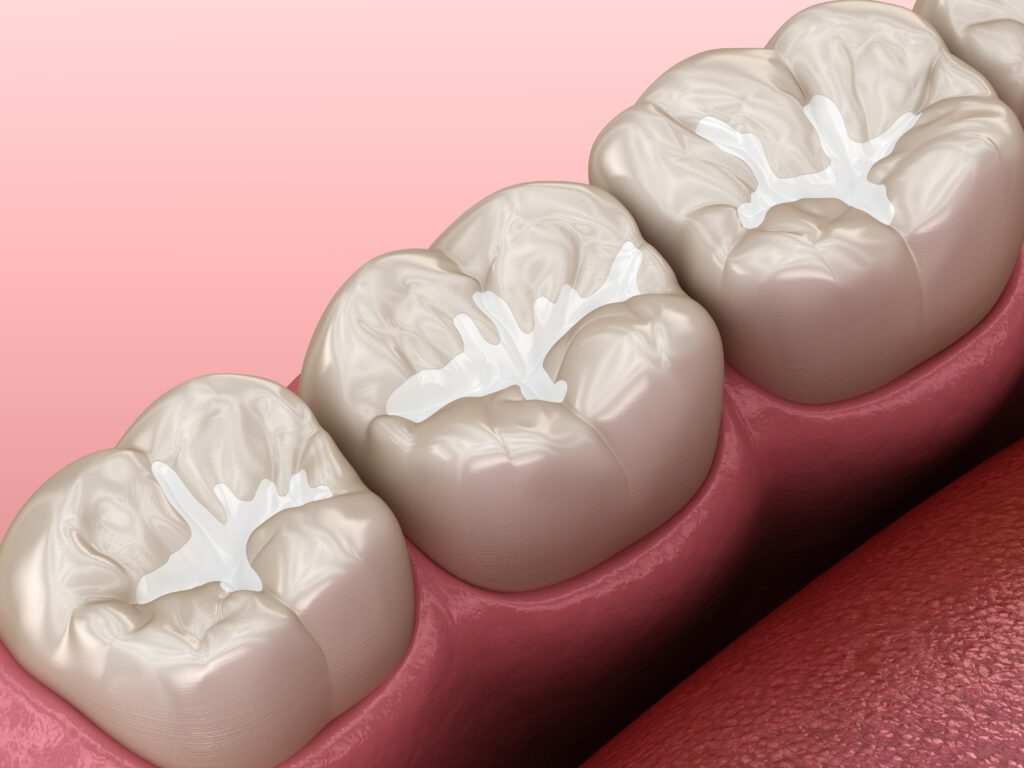 - Balsam Dental