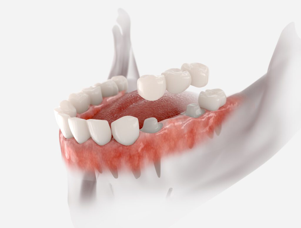- Balsam Dental