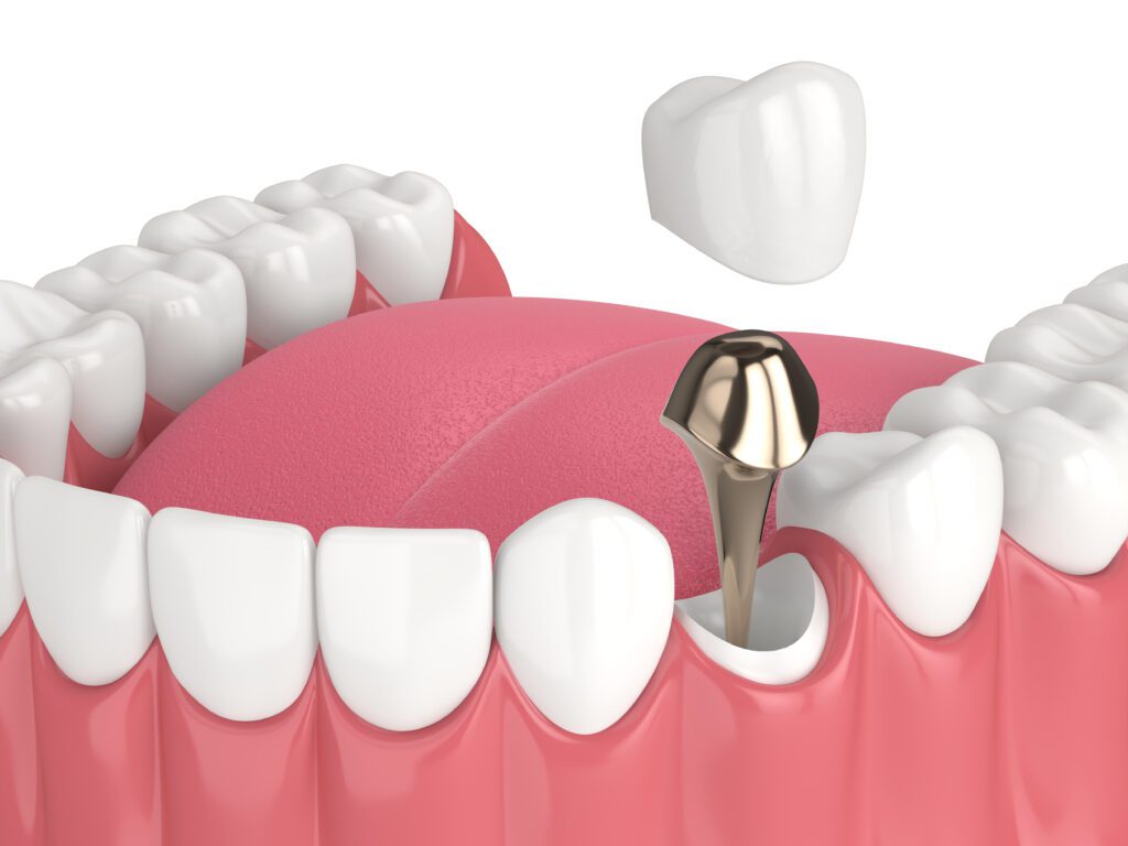 - Balsam Dental