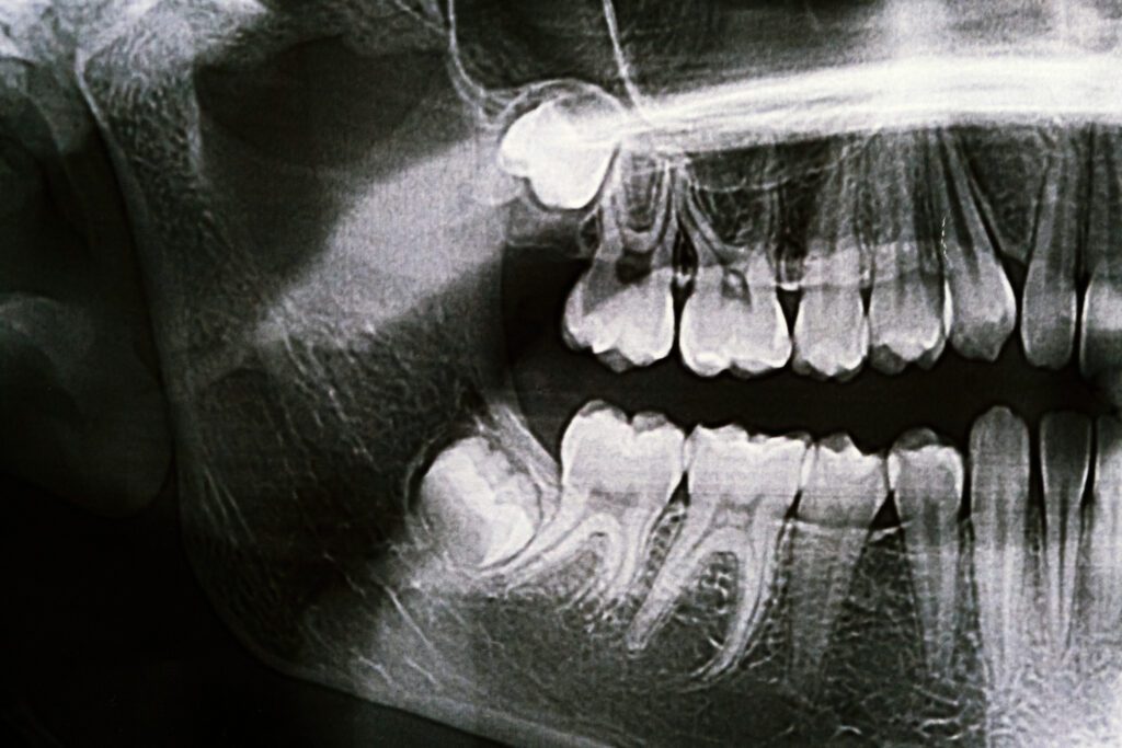 - Balsam Dental