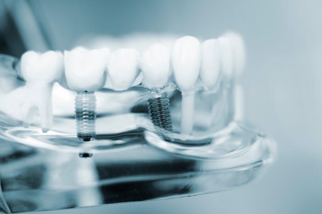 - Balsam Dental