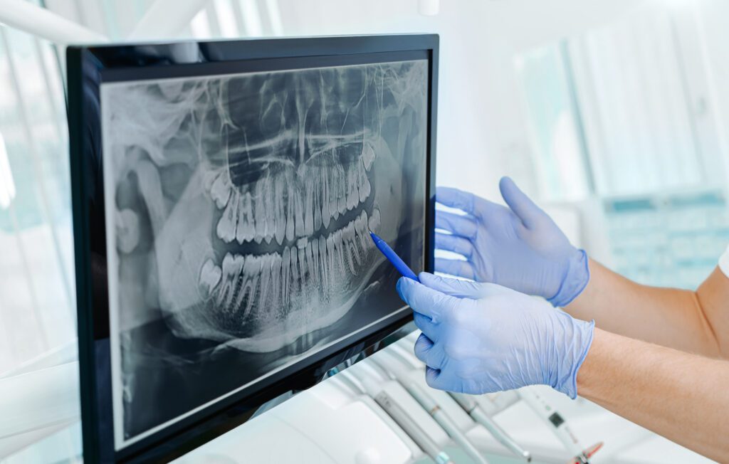 - Balsam Dental