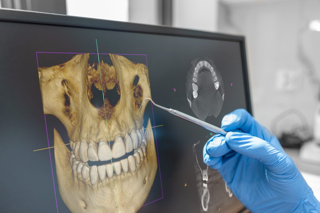 - Balsam Dental